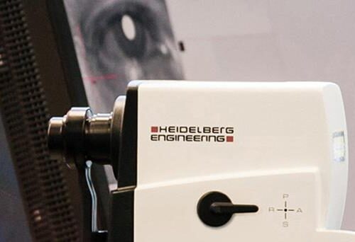 oplev-praecision-kvalitet-og-innovation-med-heidelberg-oct-systemer-fra-eyeoptics